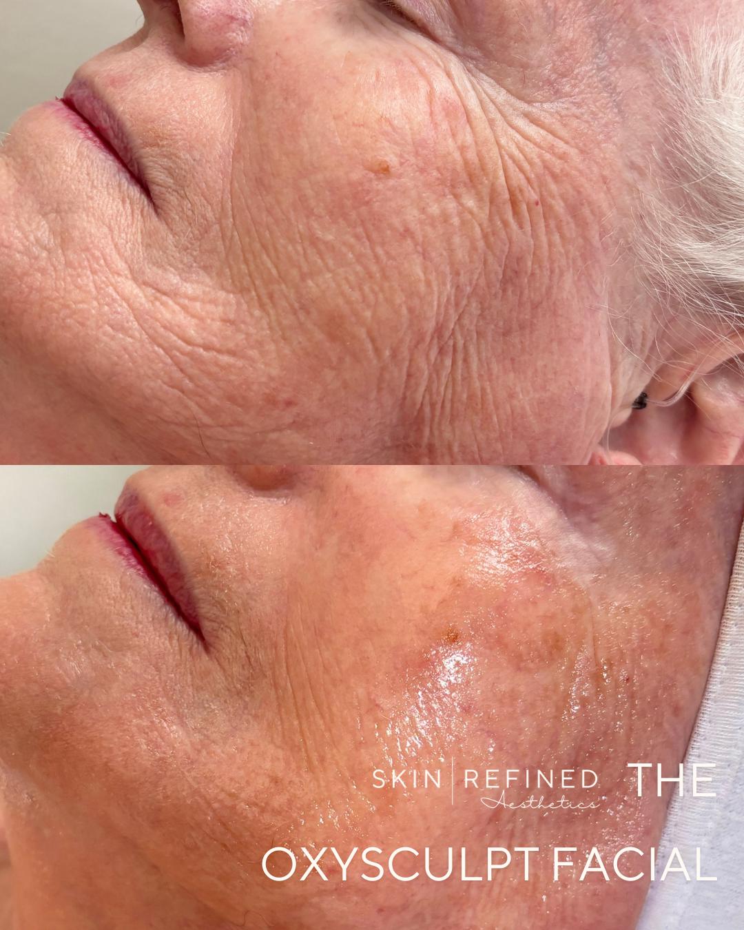 Facials for Women 40+ in Erie, Colorado: Customized Anti-Aging Solutions